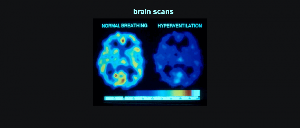brain scans showing drop in oxygen on over breathing