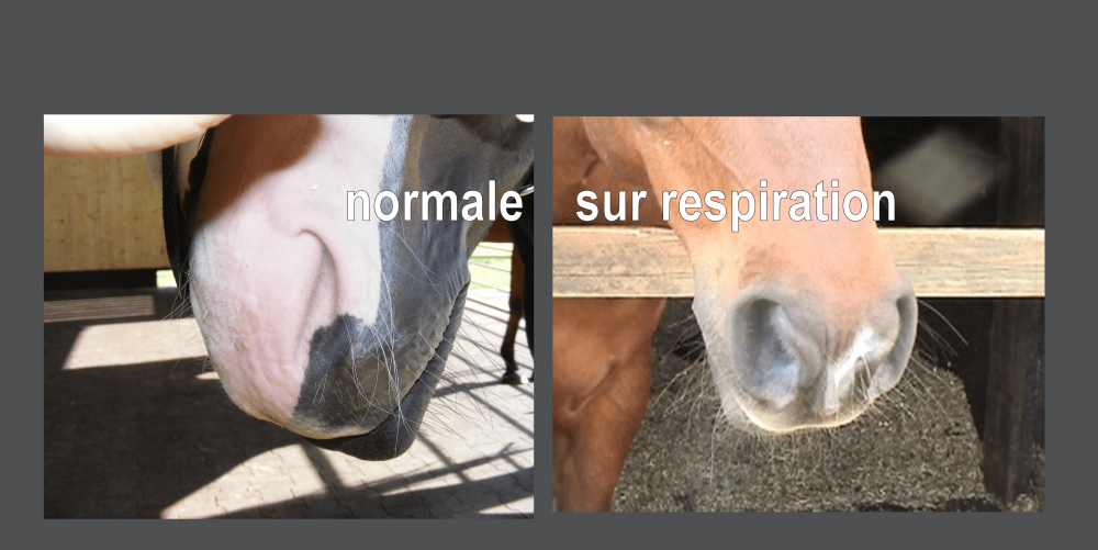un naseau normale - détendu et étroit et un naseau sur respiration - ouvert et évasé